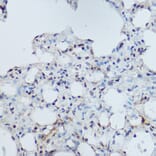 Immunohistochemistry - Anti-DDB1 Antibody (A88091) - Antibodies.com