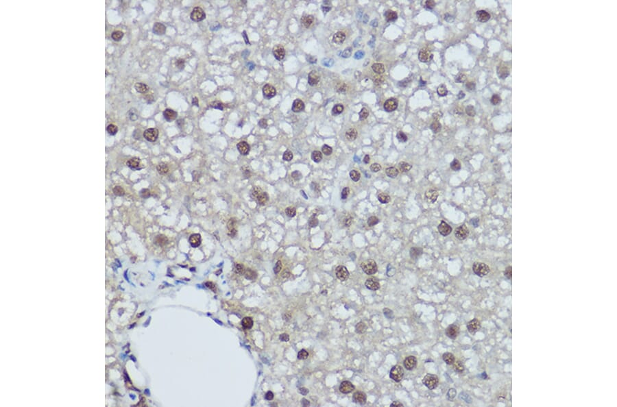 Immunohistochemistry - Anti-DDB1 Antibody (A88091) - Antibodies.com