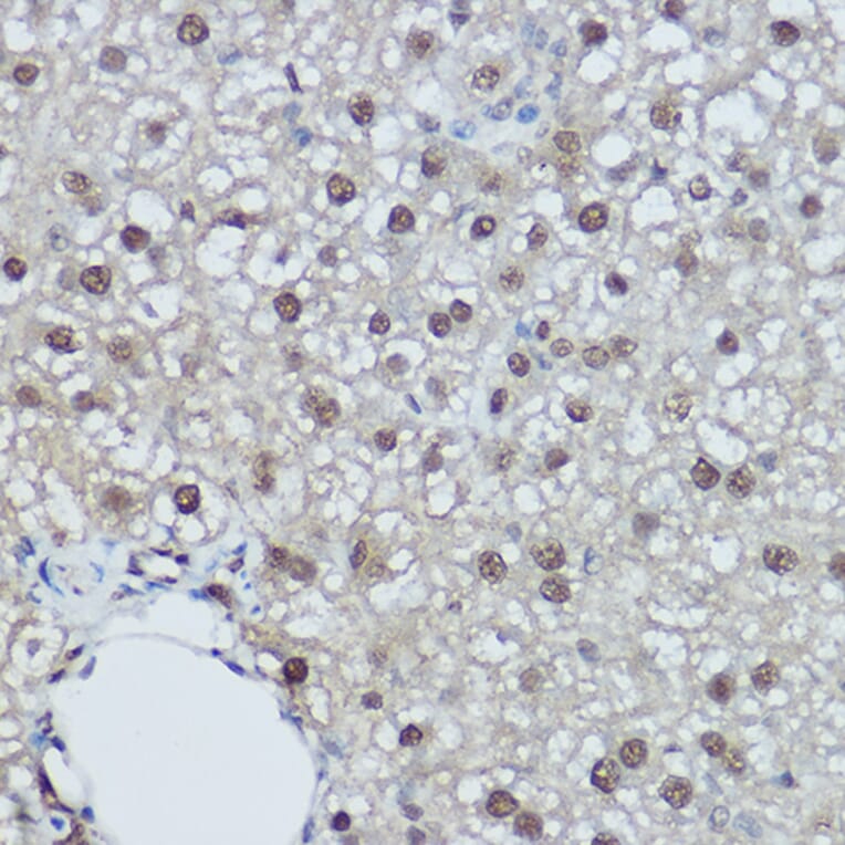 Immunohistochemistry - Anti-DDB1 Antibody (A88091) - Antibodies.com