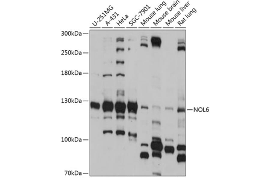 Western Blot - Anti-NOL6 Antibody (A88092) - Antibodies.com