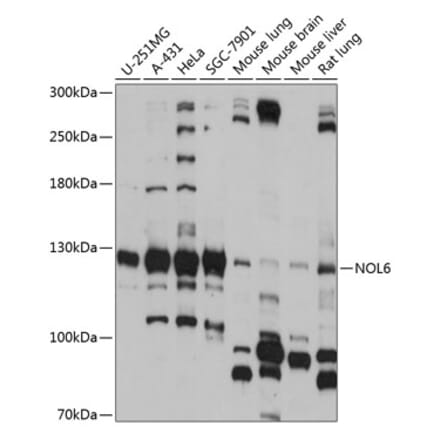 Western Blot - Anti-NOL6 Antibody (A88092) - Antibodies.com