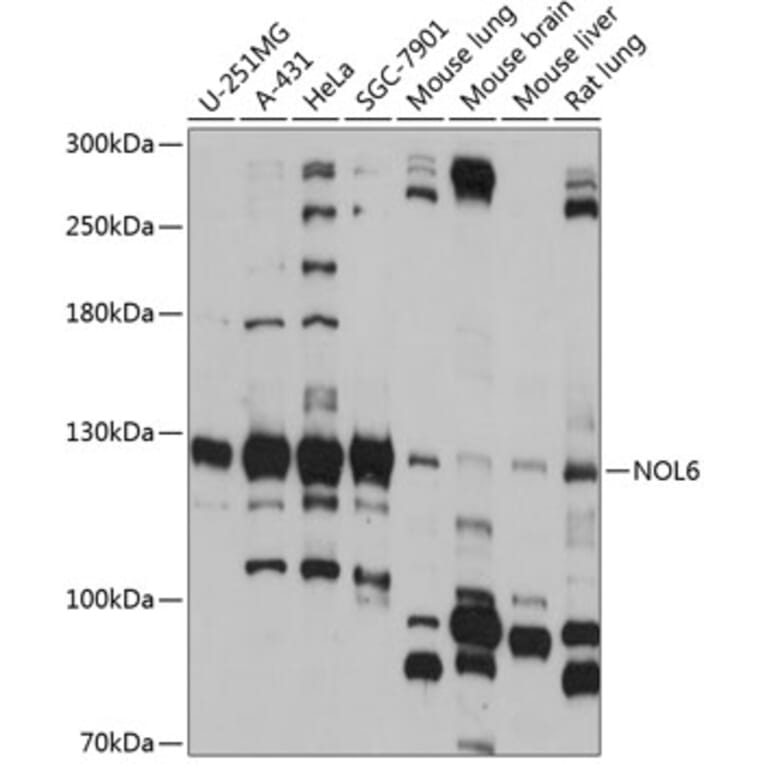 Western Blot - Anti-NOL6 Antibody (A88092) - Antibodies.com