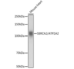 Western Blot - Anti-SERCA2 ATPase Antibody (A88093) - Antibodies.com
