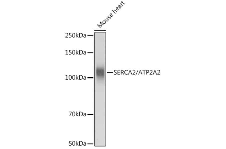 Western Blot - Anti-SERCA2 ATPase Antibody (A88093) - Antibodies.com