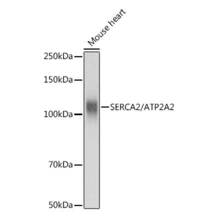 Western Blot - Anti-SERCA2 ATPase Antibody (A88093) - Antibodies.com