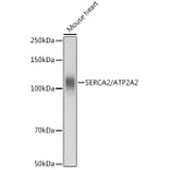 Western Blot - Anti-SERCA2 ATPase Antibody (A88093) - Antibodies.com