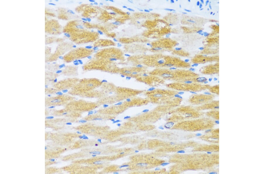 Immunohistochemistry - Anti-SERCA2 ATPase Antibody (A88093) - Antibodies.com
