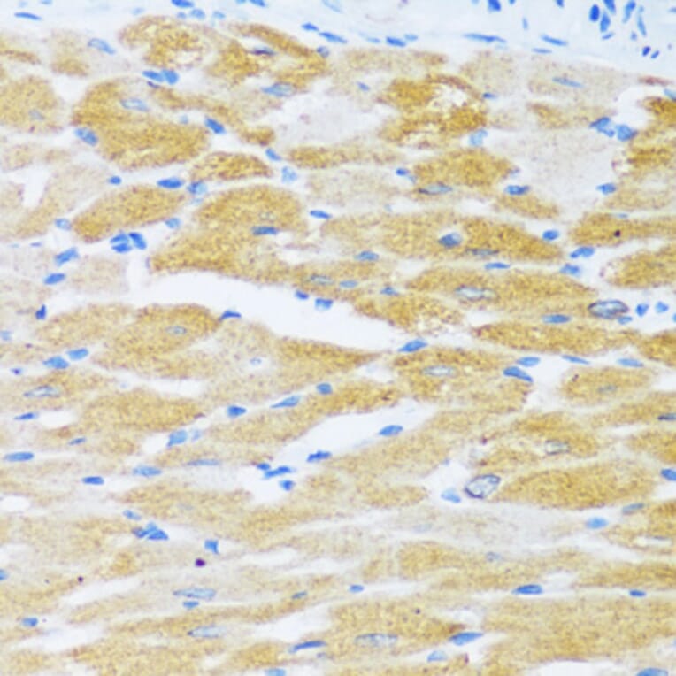 Immunohistochemistry - Anti-SERCA2 ATPase Antibody (A88093) - Antibodies.com