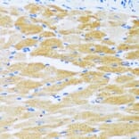Immunohistochemistry - Anti-SERCA2 ATPase Antibody (A88093) - Antibodies.com