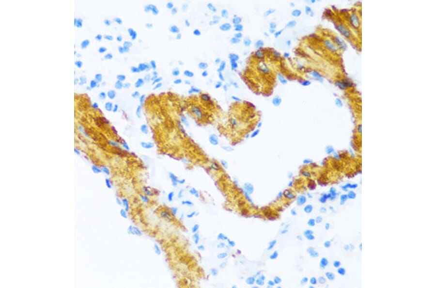 Immunohistochemistry - Anti-SERCA2 ATPase Antibody (A88093) - Antibodies.com