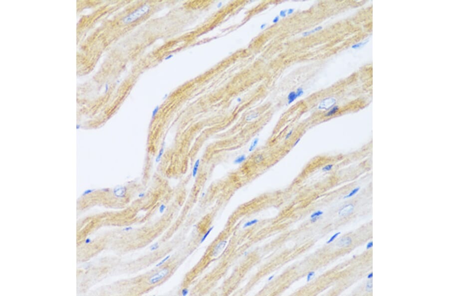 Immunohistochemistry - Anti-SERCA2 ATPase Antibody (A88093) - Antibodies.com
