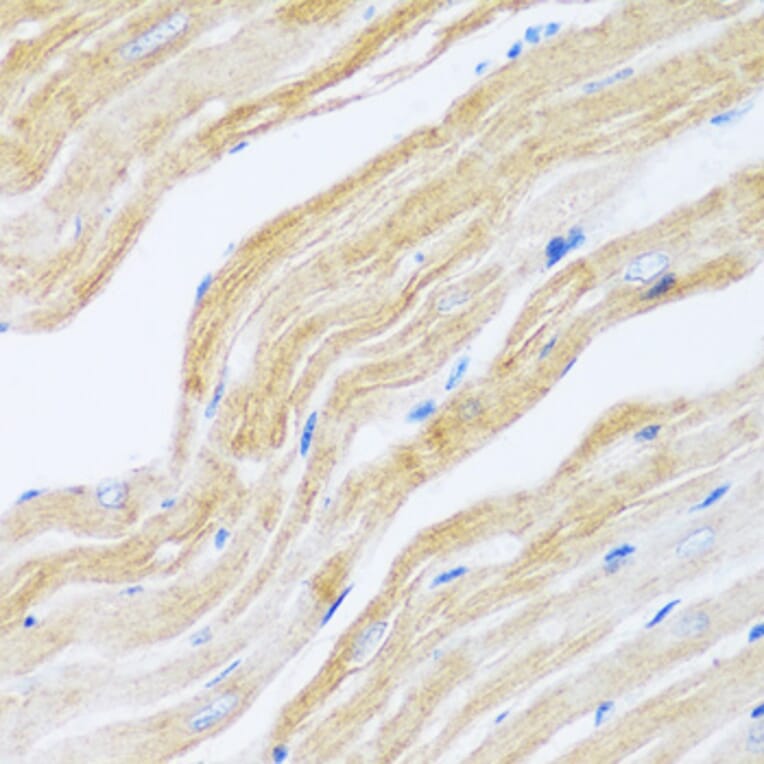 Immunohistochemistry - Anti-SERCA2 ATPase Antibody (A88093) - Antibodies.com