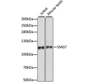 Western Blot - Anti-SMG7 Antibody (A88094) - Antibodies.com