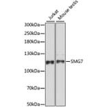 Western Blot - Anti-SMG7 Antibody (A88094) - Antibodies.com