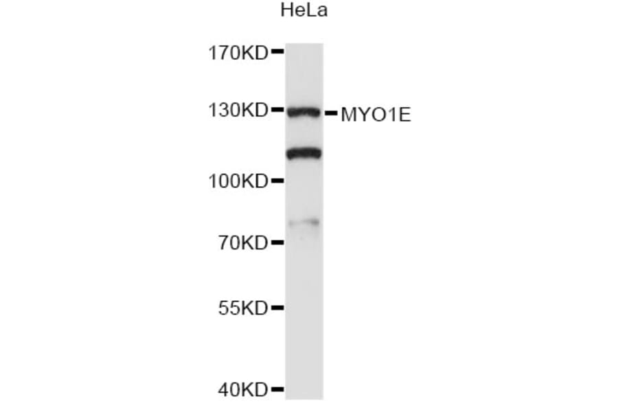 Western Blot - Anti-MYO1E Antibody (A13032) - Antibodies.com