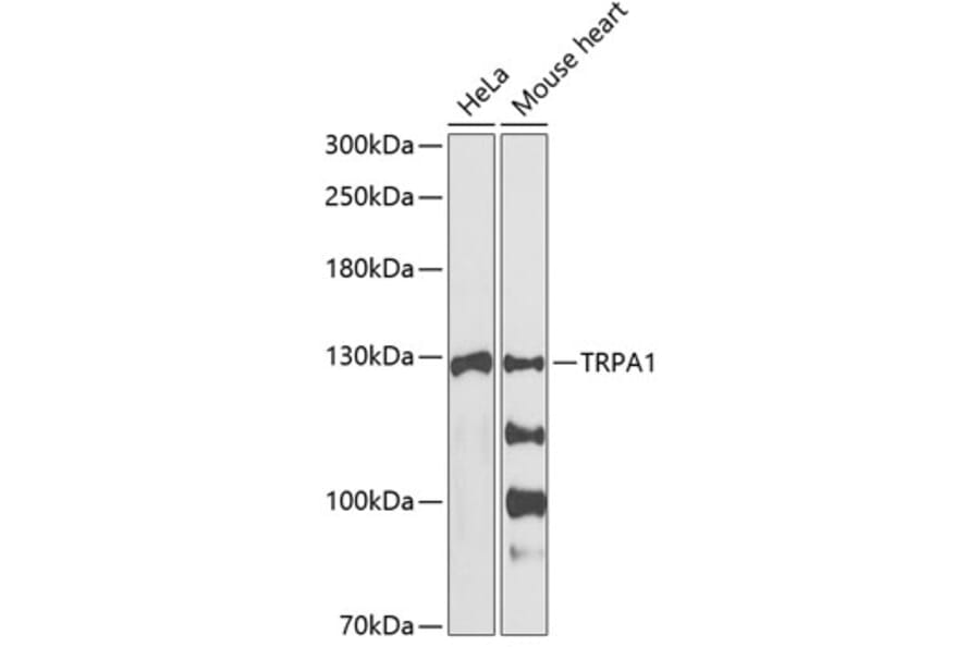 Western Blot - Anti-TRPA1 / TSA Antibody (A88096) - Antibodies.com