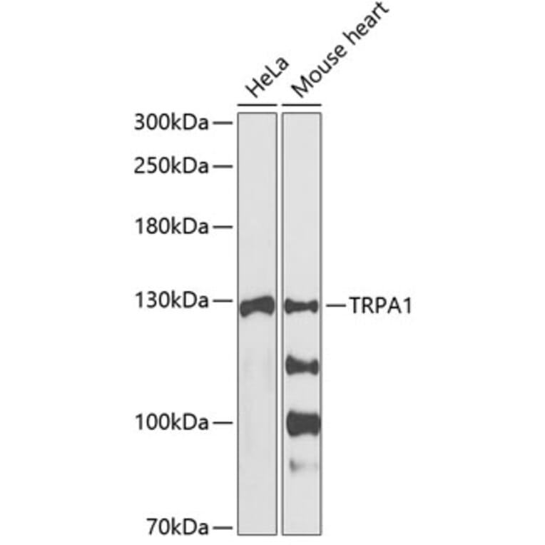 Western Blot - Anti-TRPA1 / TSA Antibody (A88096) - Antibodies.com