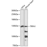 Western Blot - Anti-TRPA1 / TSA Antibody (A88096) - Antibodies.com