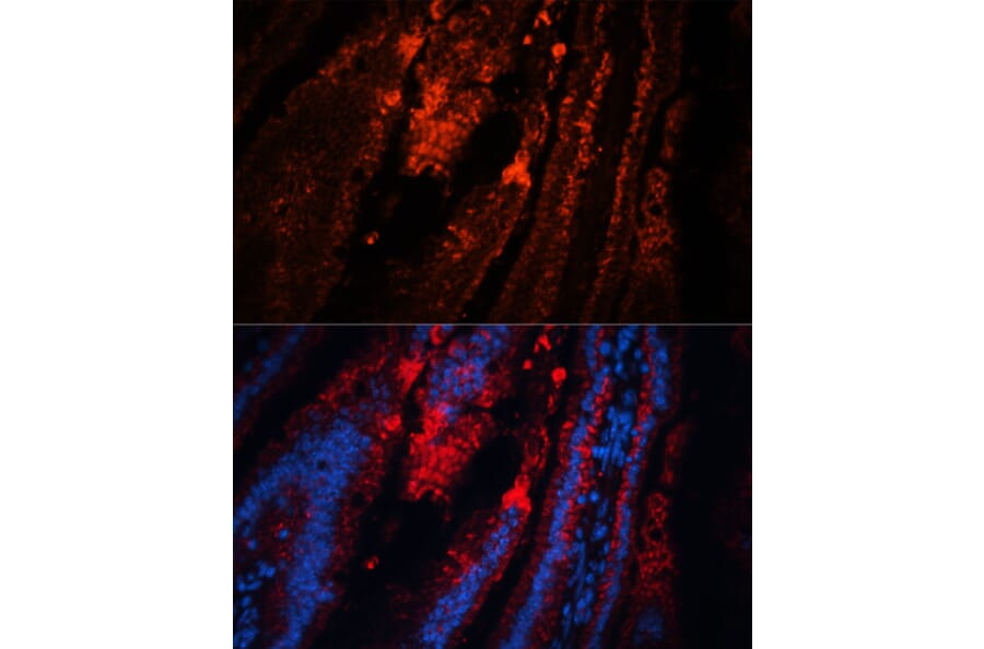 Immunofluorescence - Anti-TRPA1 / TSA Antibody (A88096) - Antibodies.com