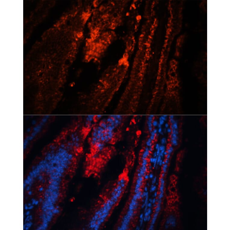 Immunofluorescence - Anti-TRPA1 / TSA Antibody (A88096) - Antibodies.com
