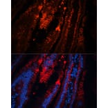 Immunofluorescence - Anti-TRPA1 / TSA Antibody (A88096) - Antibodies.com