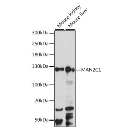 Western Blot - Anti-MAN2C1 Antibody (A88097) - Antibodies.com