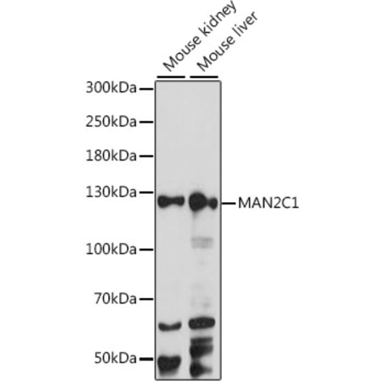 Western Blot - Anti-MAN2C1 Antibody (A88097) - Antibodies.com