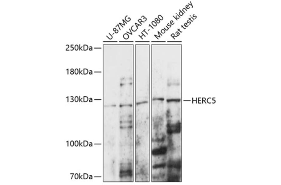 Western Blot - Anti-HERC5 Antibody (A88098) - Antibodies.com