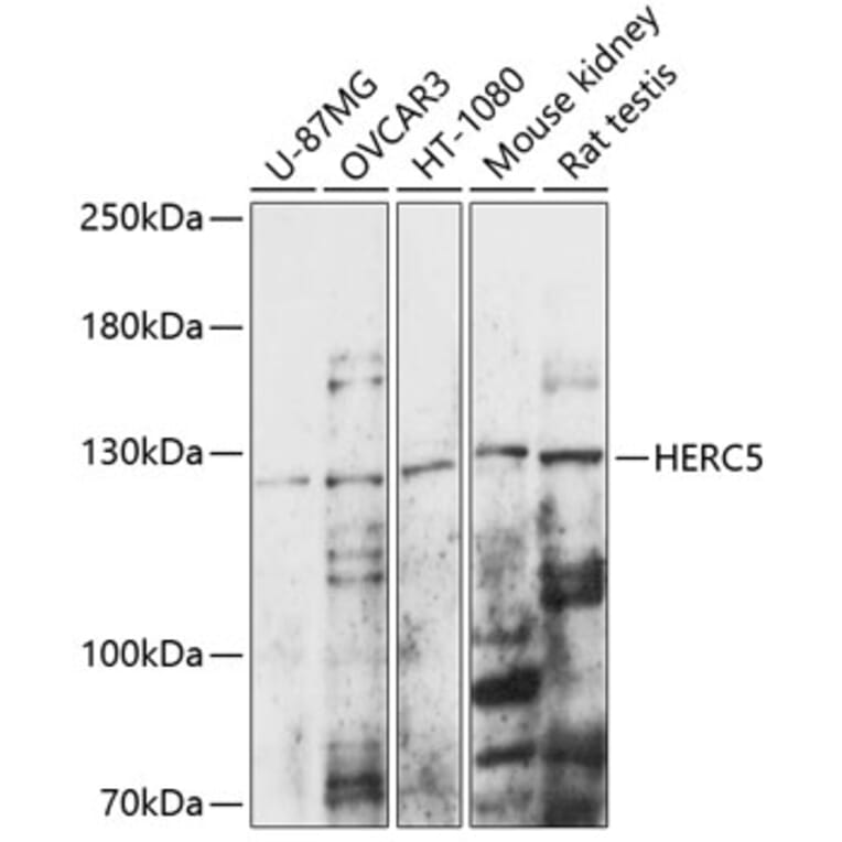 Western Blot - Anti-HERC5 Antibody (A88098) - Antibodies.com