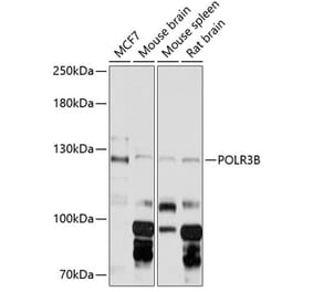 Western Blot - Anti-POLR3B Antibody (A88099) - Antibodies.com