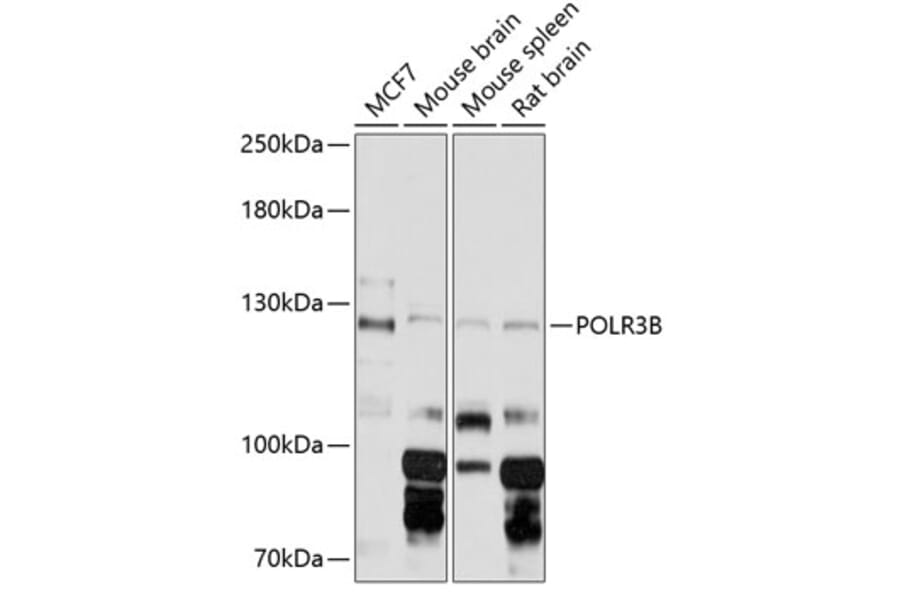 Western Blot - Anti-POLR3B Antibody (A88099) - Antibodies.com