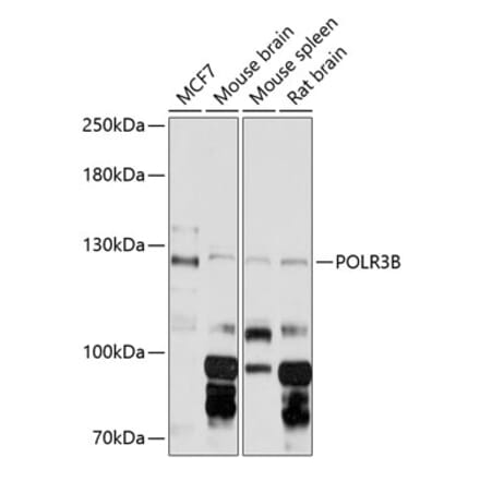 Western Blot - Anti-POLR3B Antibody (A88099) - Antibodies.com