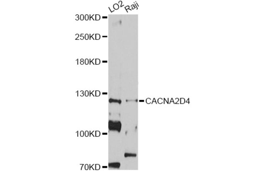Western Blot - Anti-CACNA2D4 Antibody (A12287) - Antibodies.com