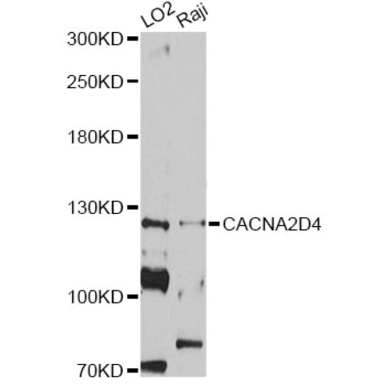 Western Blot - Anti-CACNA2D4 Antibody (A12287) - Antibodies.com