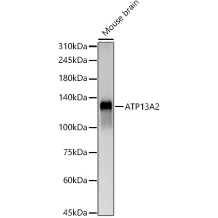 Western Blot - Anti-ATP13A2 Antibody (A88101) - Antibodies.com