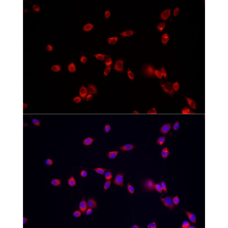 Immunofluorescence - Anti-ATP13A2 Antibody (A88101) - Antibodies.com