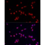 Immunofluorescence - Anti-ATP13A2 Antibody (A88101) - Antibodies.com