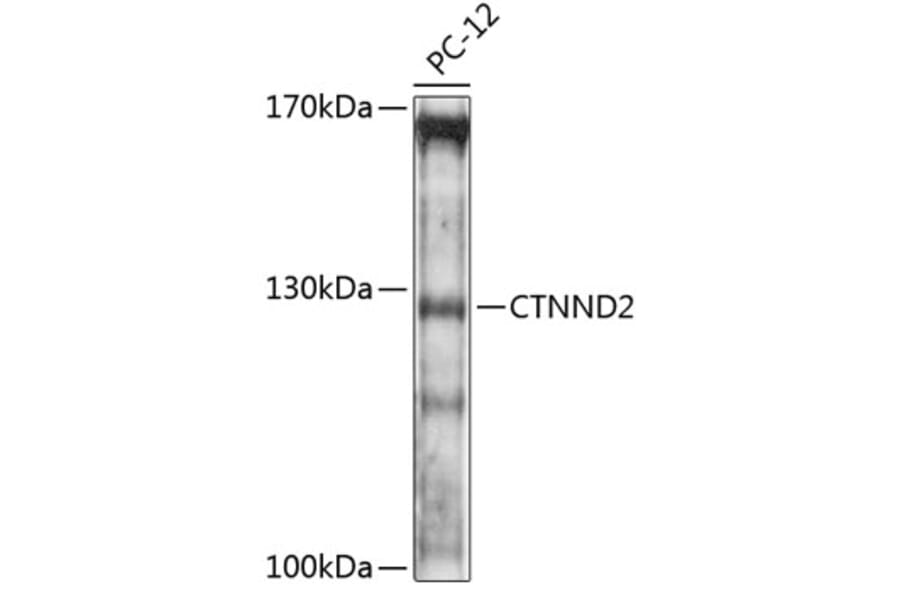 Western Blot - Anti-Delta-catenin Antibody (A88102) - Antibodies.com