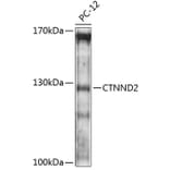 Western Blot - Anti-Delta-catenin Antibody (A88102) - Antibodies.com