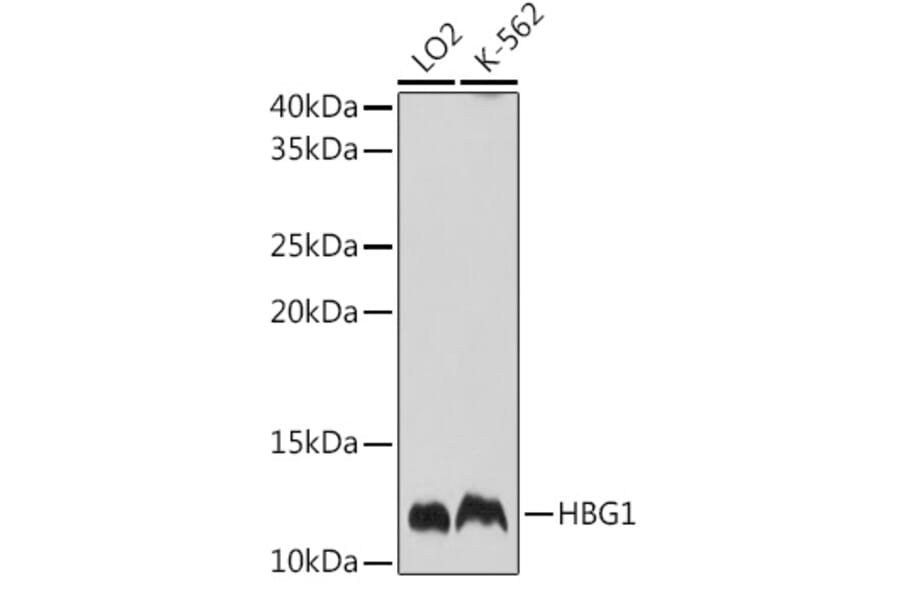 Western Blot - Anti-Fetal Hemoglobin Antibody (A88103) - Antibodies.com