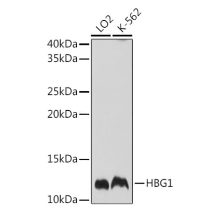 Western Blot - Anti-fetal hemoglobin Antibody (A88103) - Antibodies.com