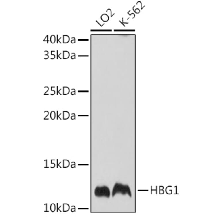 Western Blot - Anti-Fetal Hemoglobin Antibody (A88103) - Antibodies.com