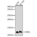 Western Blot - Anti-Fetal Hemoglobin Antibody (A88103) - Antibodies.com