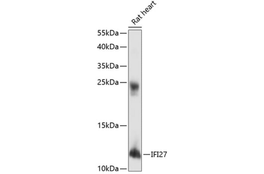 Western Blot - Anti-IFI27 Antibody (A88104) - Antibodies.com