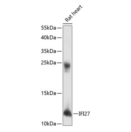 Western Blot - Anti-IFI27 Antibody (A88104) - Antibodies.com