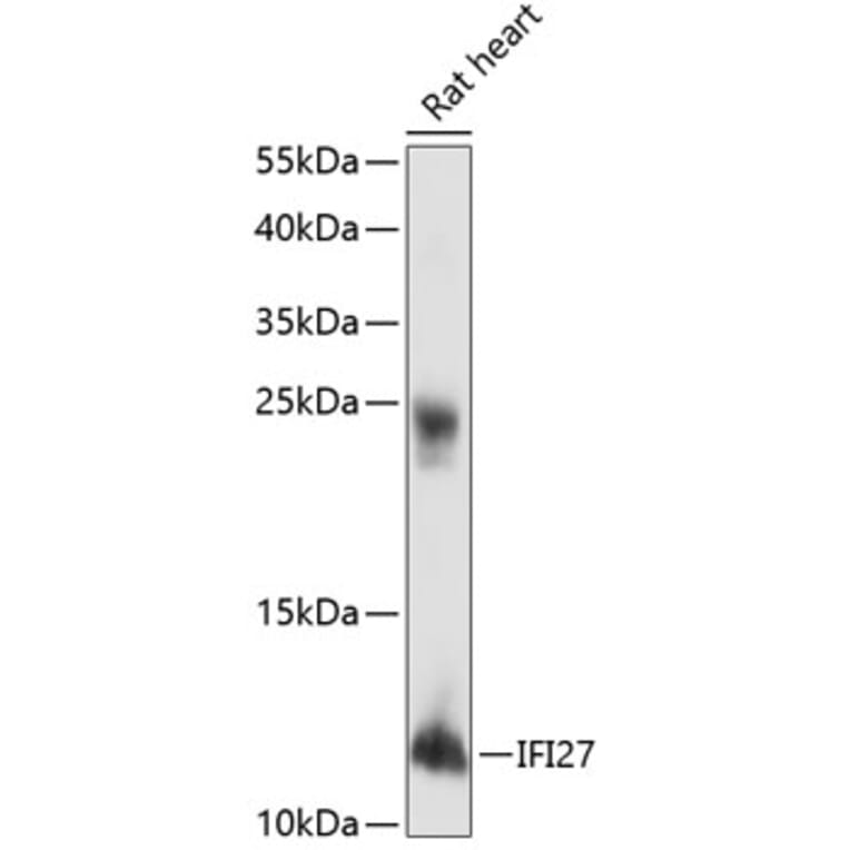 Western Blot - Anti-IFI27 Antibody (A88104) - Antibodies.com