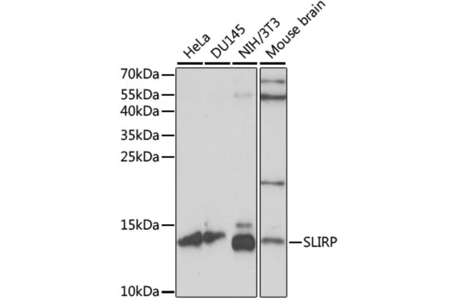 Western Blot - Anti-SLIRP Antibody (A88105) - Antibodies.com