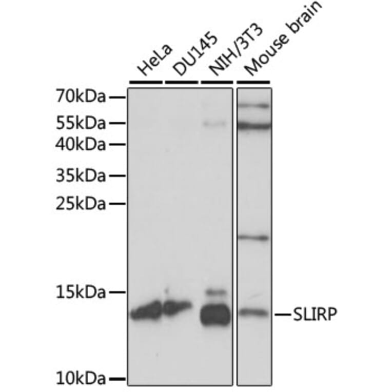 Western Blot - Anti-SLIRP Antibody (A88105) - Antibodies.com