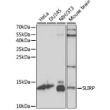 Western Blot - Anti-SLIRP Antibody (A88105) - Antibodies.com