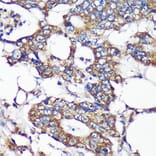 Immunohistochemistry - Anti-SLIRP Antibody (A88105) - Antibodies.com